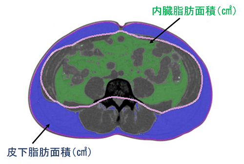 内蔵脂肪面積測定検査