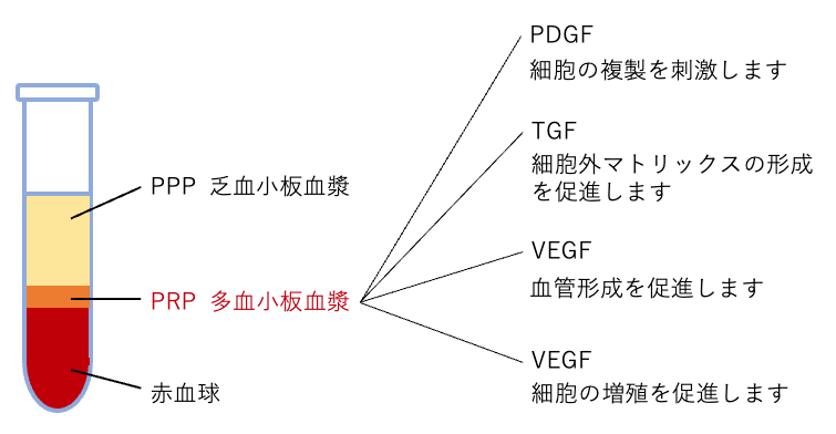 PRP治療とは