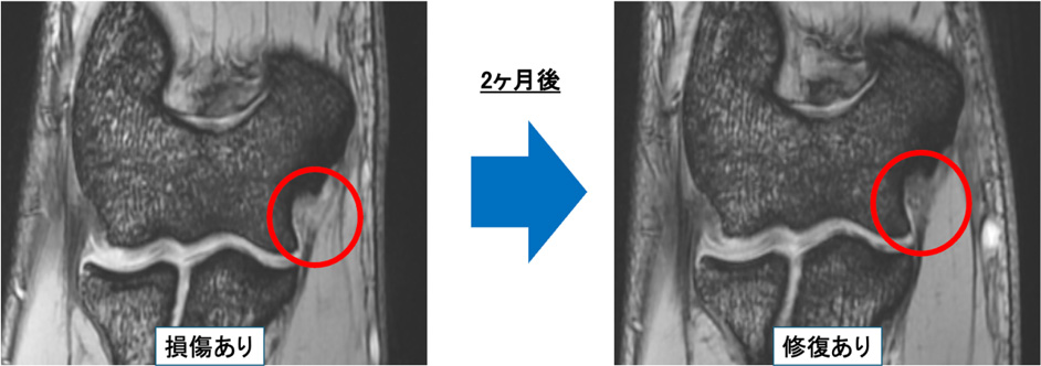 MRI