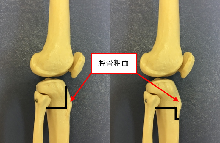 図4 骨切り位置