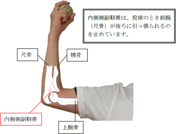 図1 内側側副靭帯(尺側側副靭帯：UCL) 